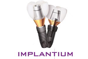Implantium